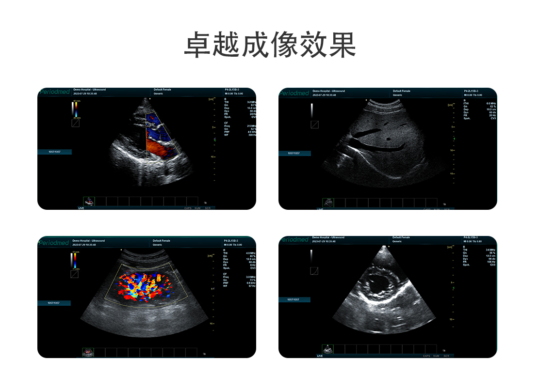 中文網(wǎng)站-PU-VML151A_05.jpg